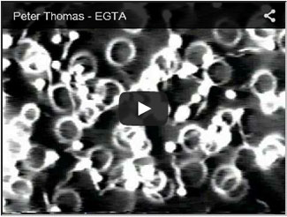 EGTA---Peter-Thomas