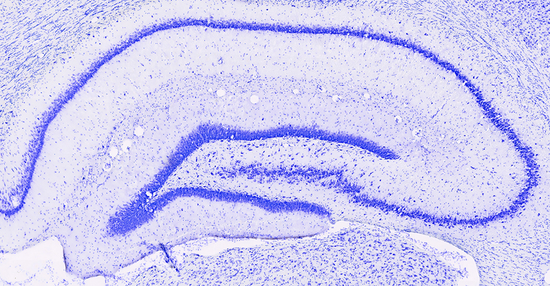 The hippocampus. Image courtesy of the Colgin lab.