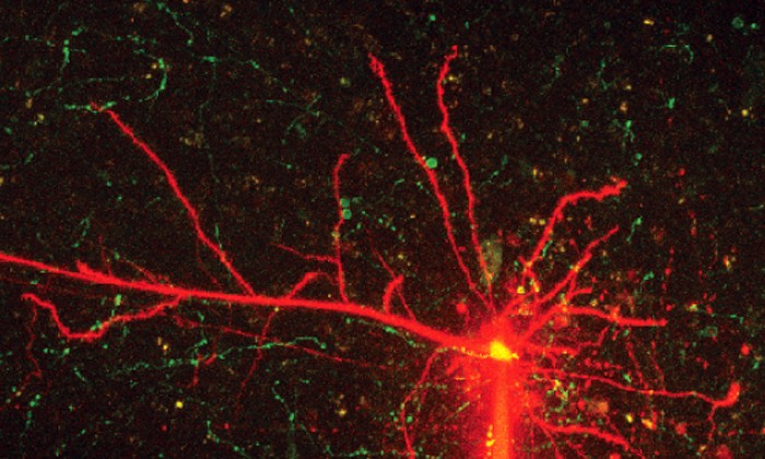 Understanding the Prefrontal Cortex